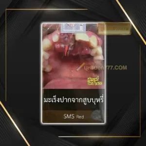 SMS แดง